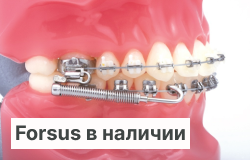 Аппарат Форсус ЗM в наличии!